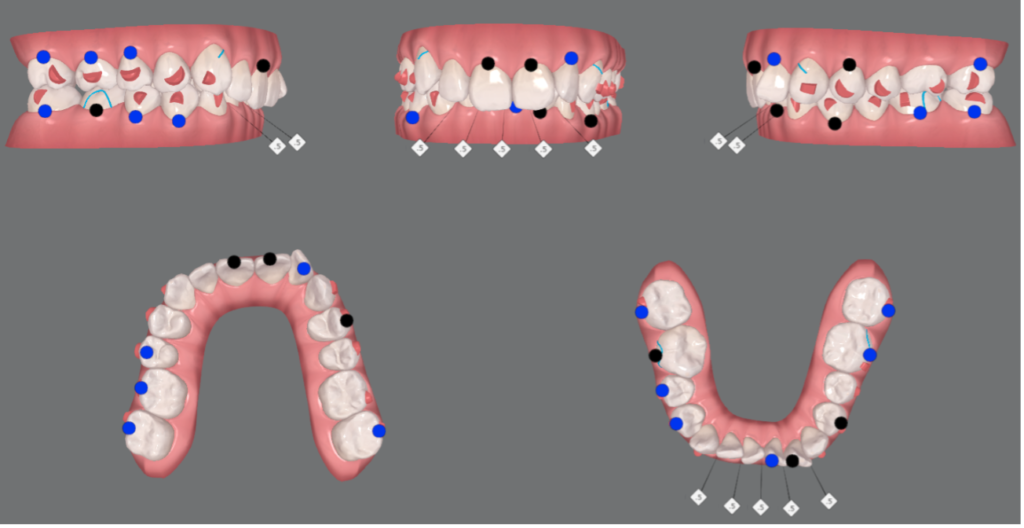 before04-1024x528-1